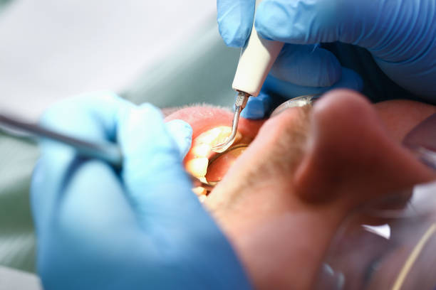 Best Knocked-Out Tooth Emergency  in Darien, WI