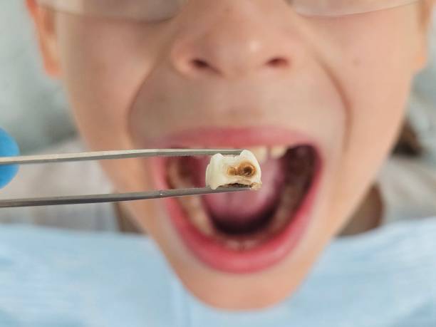 Best Emergency Pediatric Dentist  in Darien, WI